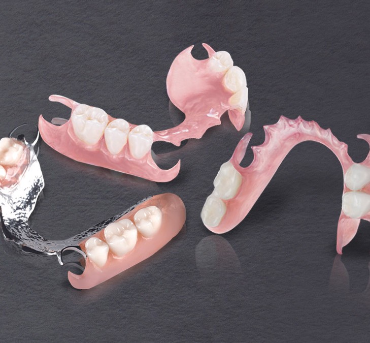 Flexible Denture (Invisible Clasping)